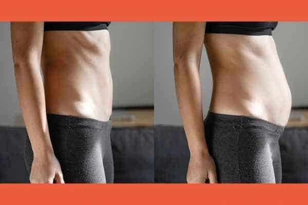 LA-EMS Body Sculpting results Bridgnorth