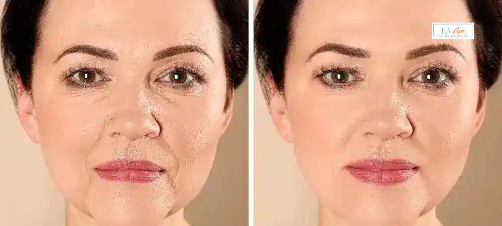 Why Aren’t My Skincare Products Making My Sagging Skin Look Firmer Bridgnorth?
