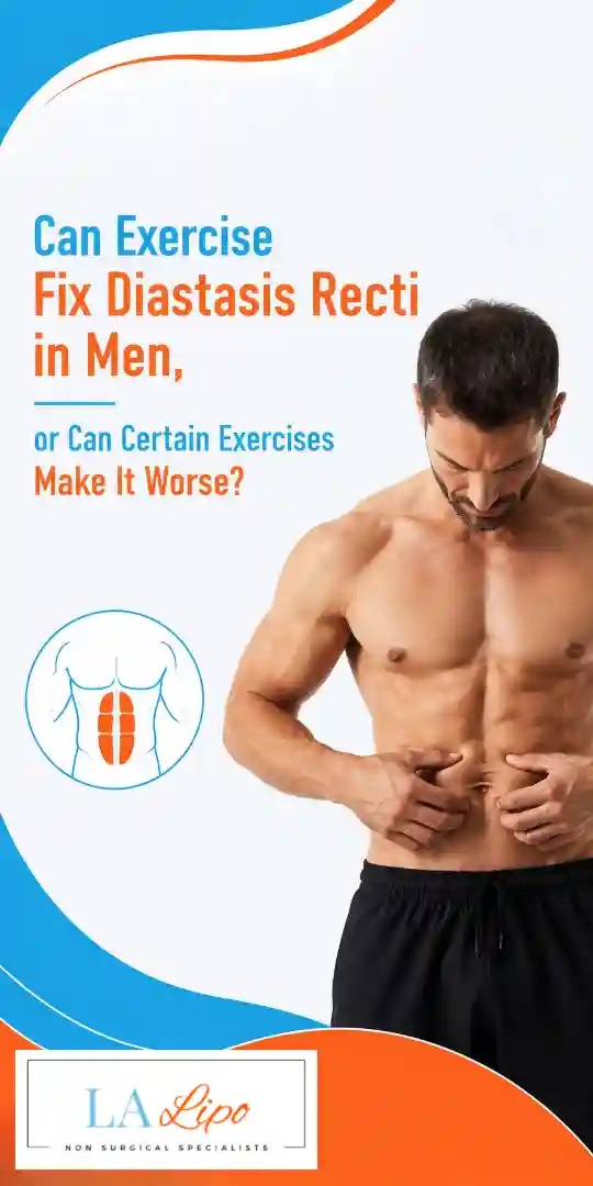 Can Exercise Fix Diastasis Recti in Men, or Can Certain Exercises Make It Worse Bridgnorth?